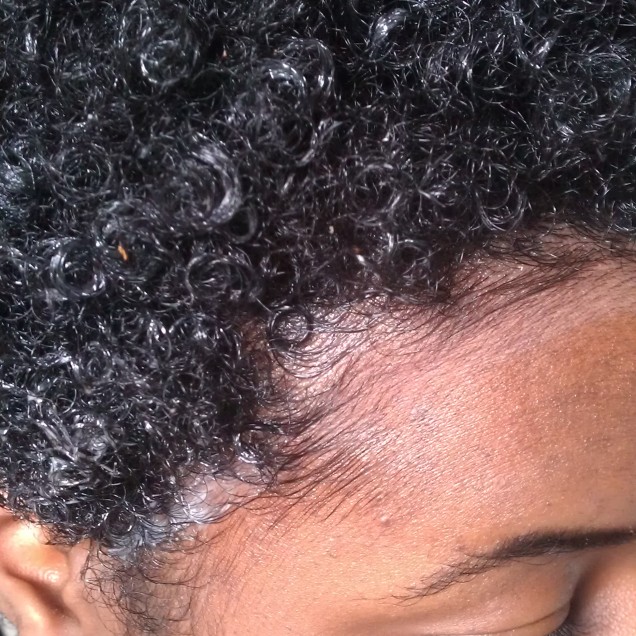 This is my curl pattern with the conditioner and gel. This picture was around one month after I BC'd